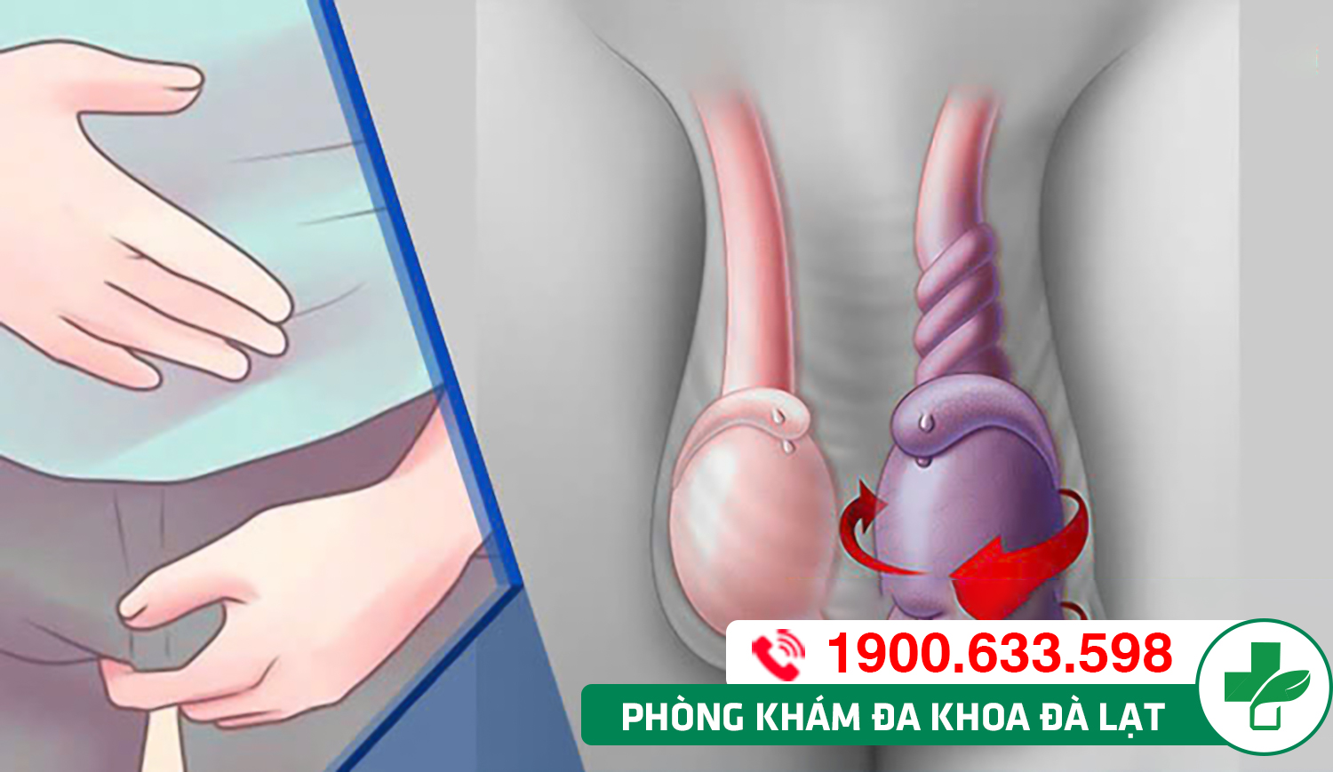 NỔI HẠCH Ở TINH HOÀN BÁO HIỆU ĐIỀU GÌ